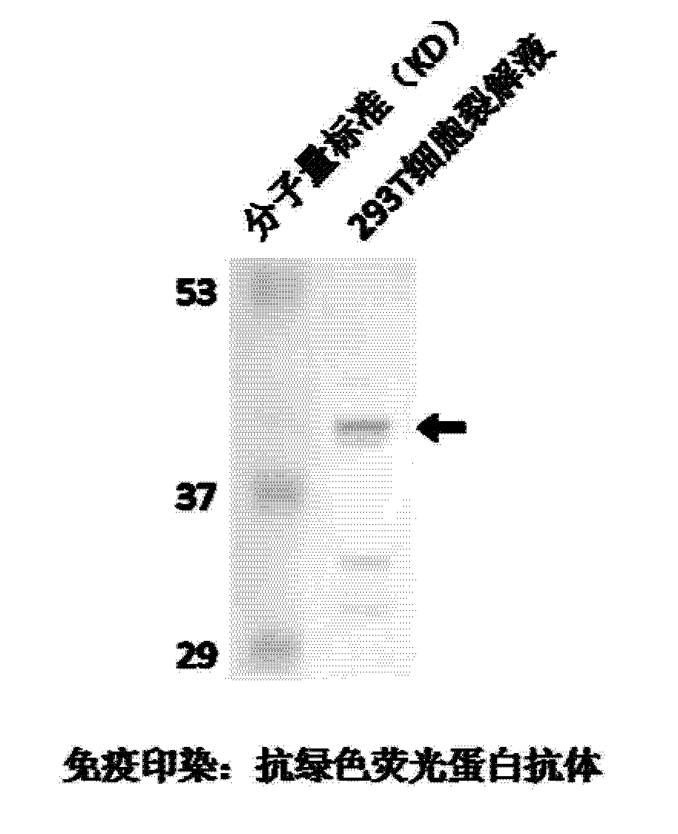 一种转移肿瘤缺失蛋白抑制剂多肽