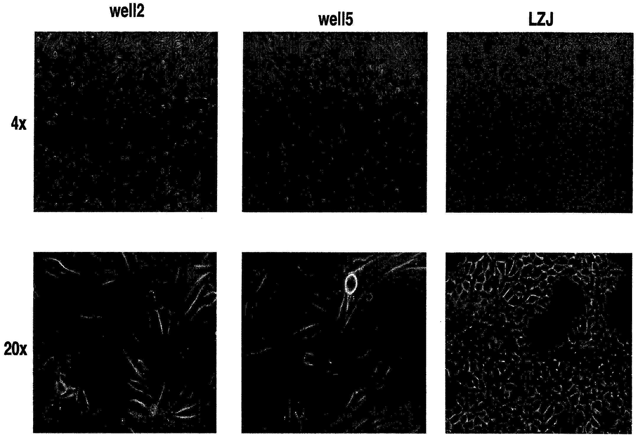 一组人成骨肉瘤细胞系及小鼠体内移植模型